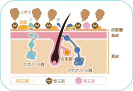 肌における、常在菌、悪玉菌、善玉菌それぞれの作用を表した図