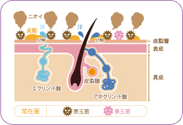 肌における、常在菌、悪玉菌、善玉菌それぞれの作用を表した図